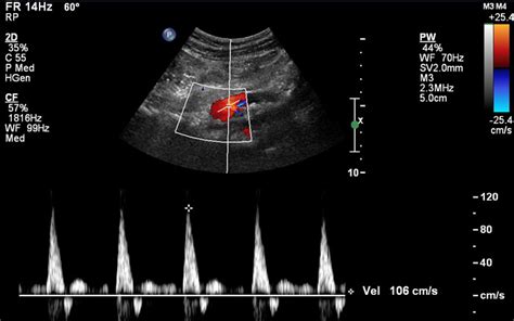 Abdominal Duplex Ultrasound Offered In Baltimore Mercy