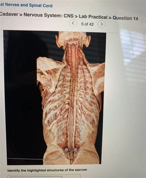 Solved Al Nerves And Spinal Cord Cadaver Nervous System Chegg