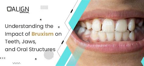 Understanding The Impact Of Bruxism On Teeth Jaws And Oral Structures Best Dental Clinic In