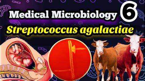 Streptococcus Agalactiae Gbs شرح بالعربي Youtube