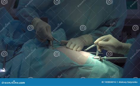 Operation Using Laparoscopic Equipment Surgeons Team Hospital Stock