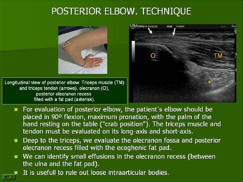 Ultrasound Of The Elbow What The Radiologist Should Know Semantic