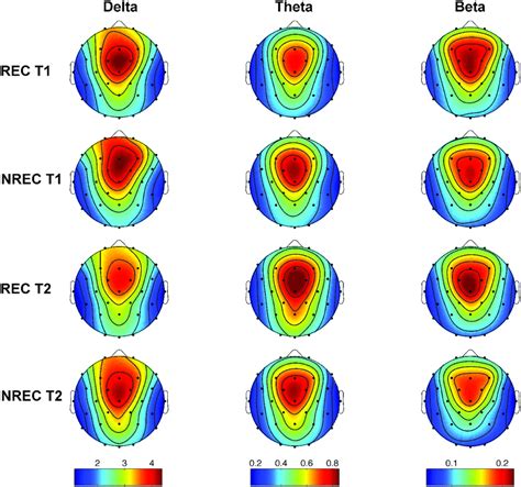 Topographic Distribution Of Eeg Powers During The Last 5 Min Of Rem