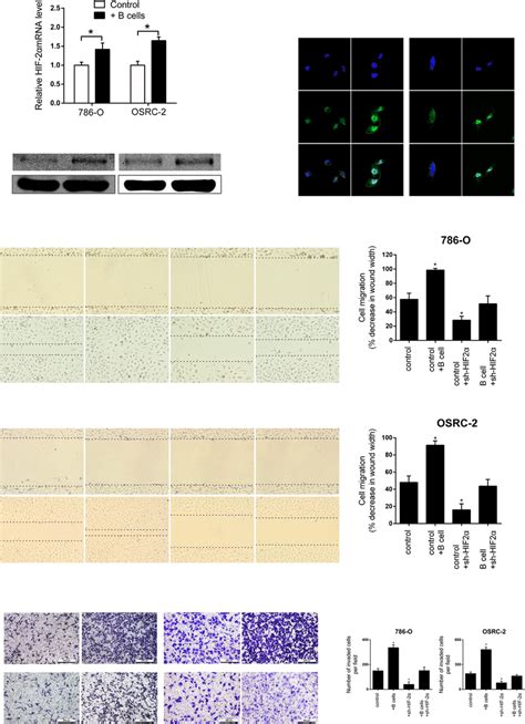 B Cells Promoted Rcc Cell Migration And Invasion Through The Increase