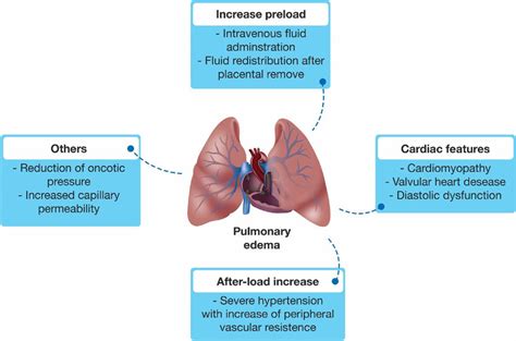 Multifactorial Etiology Of Pulmonary Edema In Preeclampsia Download