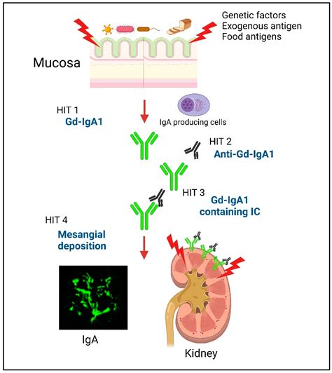 Mucosal Immune System Dysregulation In The Pathogenesis Of Iga Nephropathy