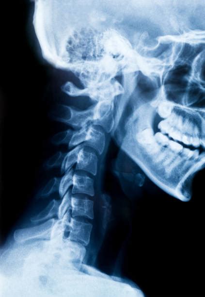 Radiogram Gambar X Ray Foto Stok Potret And Gambar Bebas Royalti Istock