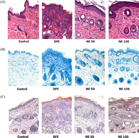 Effect Of Ne On The Dermal Infiltration Of Inflammatory Cells And Download Scientific Diagram