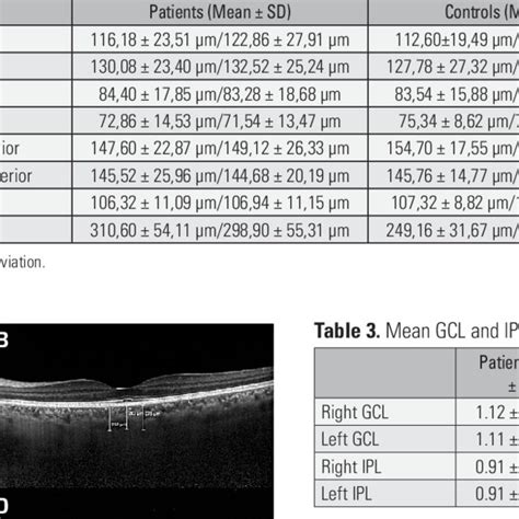 Measurement Of RNFL Thicknesses With Spectral OCT A The Circle Is