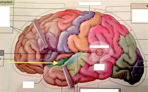 Neuroanatomy Exam Flashcards Quizlet