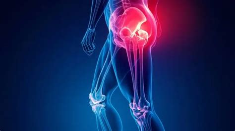 hip replacement surgery  jaipur dr lalit modi