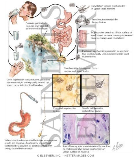 Giardiasis Pathophysiology Of Giardiasis