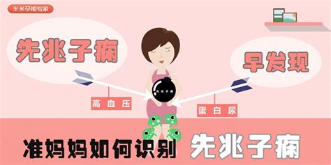 准妈妈如何识别先兆子痫？ 知乎