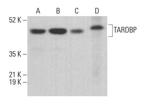 TARDBP Antibody E 10 SCBT Santa Cruz Biotechnology