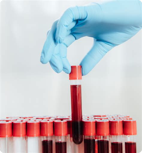 Functional Blood Chemistry Analysis | Dr. Hagmeyer