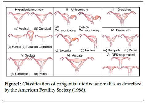 Septate Uterus As Congenital Uterine Anomaly A Case Report