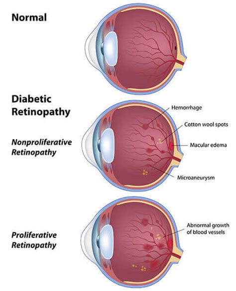 Retina Coastal Surgery Center