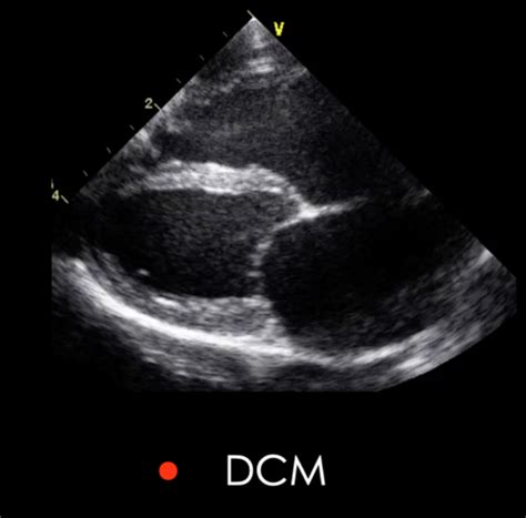 Echocardiography 1 Flashcards Quizlet