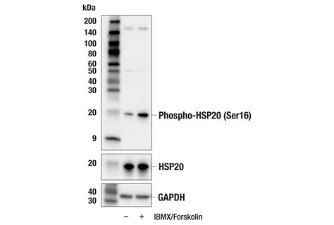 Phospho Hsp20 Ser16 E4w4x Rabbit Mab Cell Signaling Technology