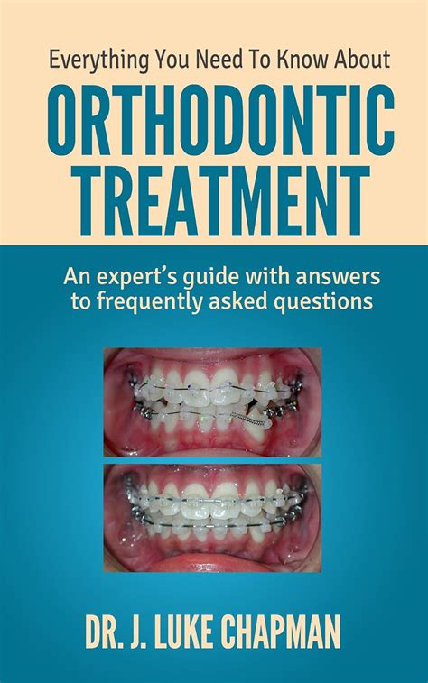 Everything You Need To Know About Orthodontic Treatment An Experts