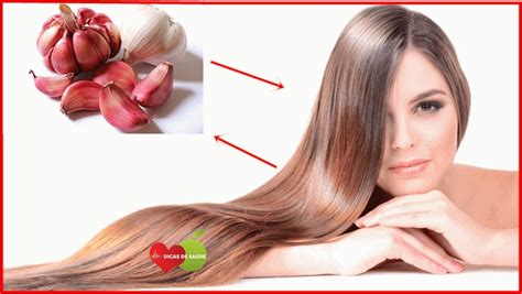 Como Acelerar O Crescimento Do Cabelo Usando Alho Dicas De Saúde