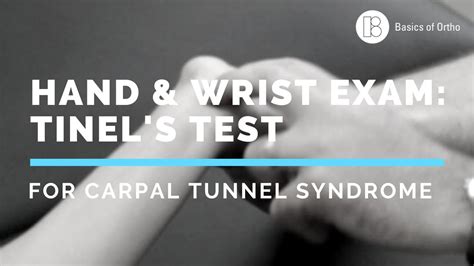 Wrist And Hand Exam Carpal Tunnel Tinels Test For Carpal Tunnel Syndrome Youtube