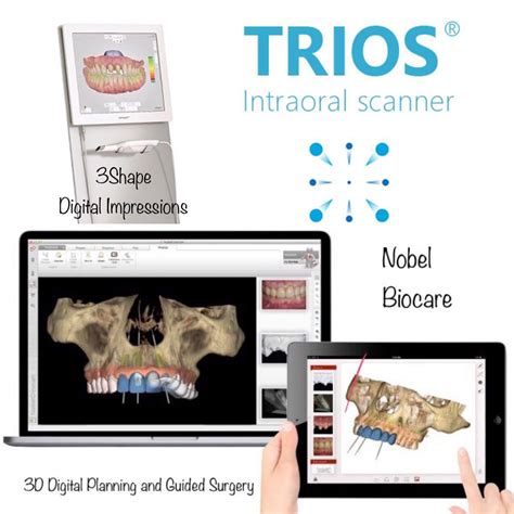 Digital Impressions And Digitally Guided Implant Treatment