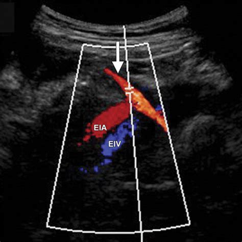 A Radiologists Guide To The Performance And Interpretation Of