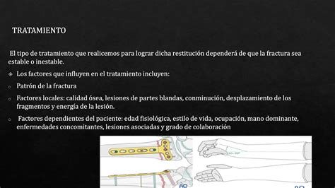 Fracturas Del Radio Distal De Miembro Superior Ppt