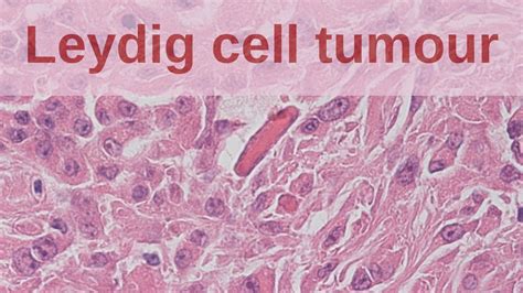 Leydig Cells Histology