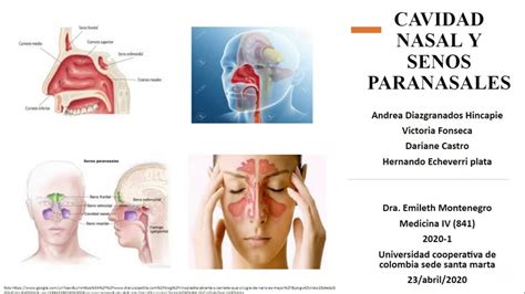 Semiología de la cavidad nasal y los senos paranasales YouTube