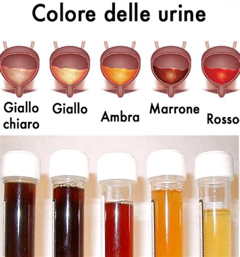 Emazie Nelle Urine Che Cosa Significa Cause Diagnosi E Trattamenti