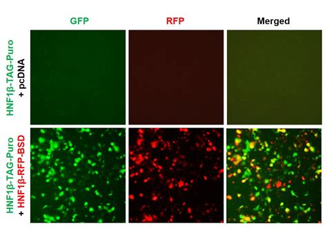 Hnf1β Reporter Lentivirus Lipexogen Biotech