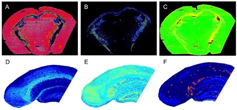 Figure 1 From GM1 Locates To Mature Amyloid Structures Implicating A