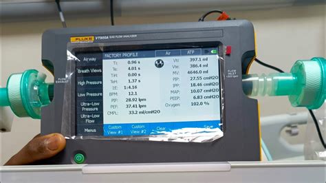 Calibrating Fluke Vt900 Gas Flow Anaylzer And Functionality Assessment Of Ventilator Youtube