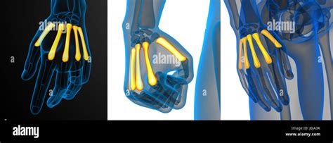 D Rendering Medical Illustration Of The Metacarpal Bone Stock Photo