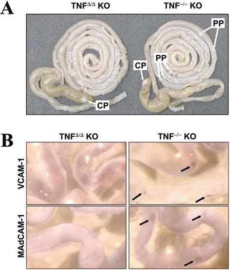 Novel Tumor Necrosis Factorknockout Mice That Lack Peyer S Patches