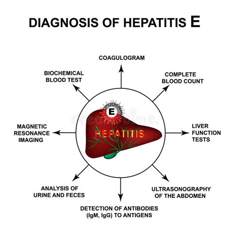 Diagnóstico Da Hepatite E Dia Da Hepatite Do Mundo Infographics Ilustra