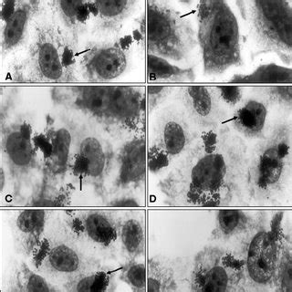 Localized Adherence Patterns In HeLa Cells Of Representative Atypical