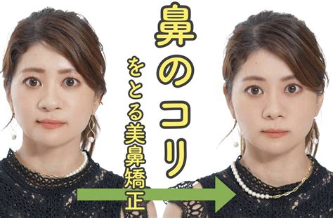 【before→after】丸い小鼻が目立つ「にんにく鼻」とうっすら「ほうれい線」がコリとりマッサージで激変！ With Online