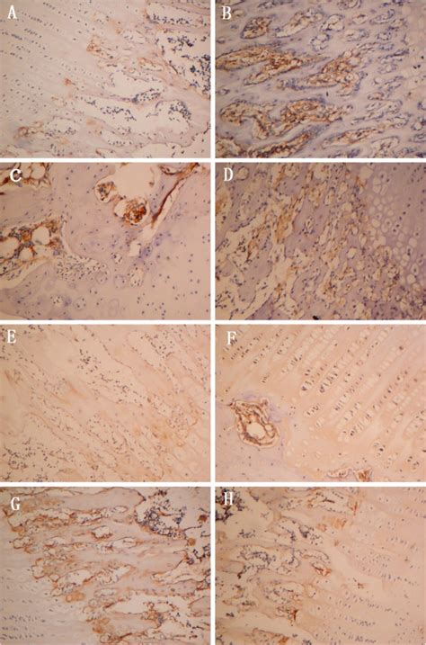 Rankl And Opg Expression In Articular Cartilage And Subchondral Bone