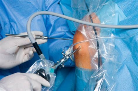 Shoulder Knee Arthroscopy Minimally Invasive Orthopedic Joint Surgery