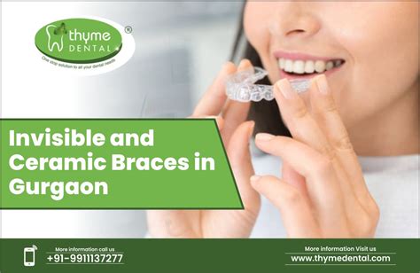 Best Invisible Braces In Gurgaon Invisible Ceramic Metal Braces