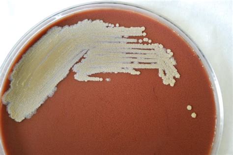 Burkholderia pseudomallei - wikidoc