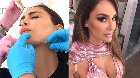 Ninel Conde Fue Exhibida Por Su Cirujano Plástico En Video Habría