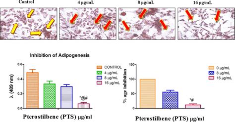 The Effect Of Pterostilbene On Inhibition Of Adipogenesis And Oil O Red