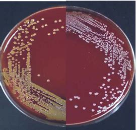 BLOCK C STAPHYLOCOCCUS Flashcards Quizlet