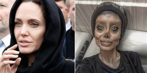 Teen Undergoes 50 Surgeries In A Bid To Look Like Her Idol Angelina