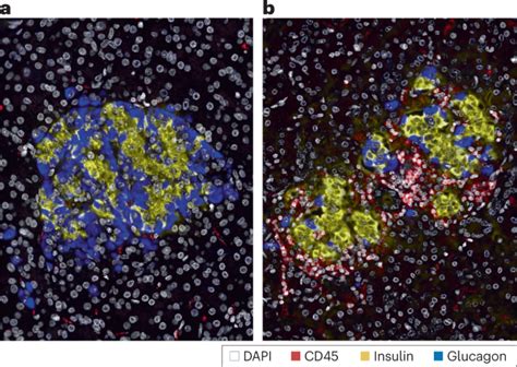 Nature Reviews Endocrinology On Twitter New Content Online