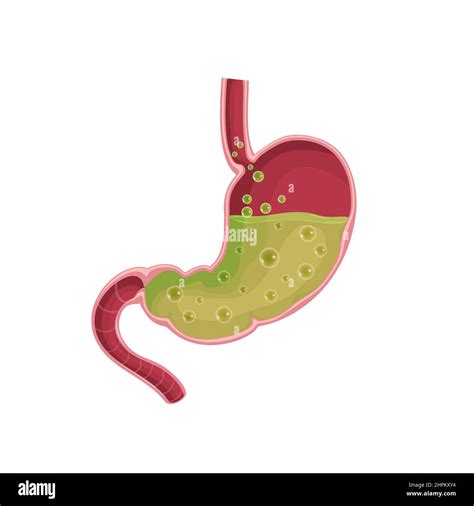 Stomach. Nausea. Diseases of the stomach. Vomiting Flat illustration ...